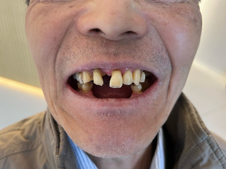 What Happens at an On-Site Dental Assessment in China?