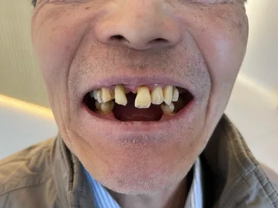 What Happens at an On-Site Dental Assessment in China?